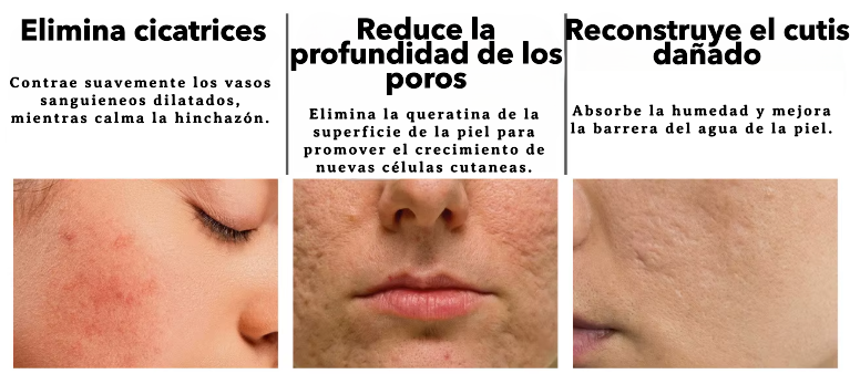 ✨OFERTA 2X1 ✨          Serum Facial con Nicotinamida, para el Cuidado de la Piel.